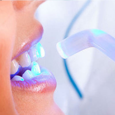 Laser Dentistry, Coral Springs and Boca Raton Florida