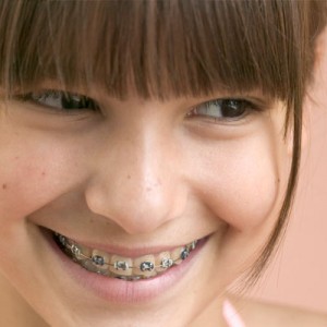 Orthodontics and Braces. Boca Raton, Florida